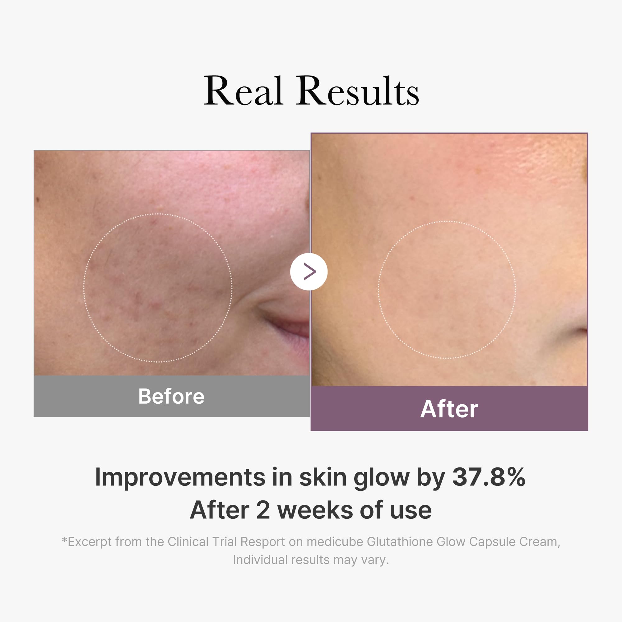 Foto 6 pulgar | Crema Facial Medicube Age-r Glutatión Glow Capsule 50 Ml - Venta Internacional.