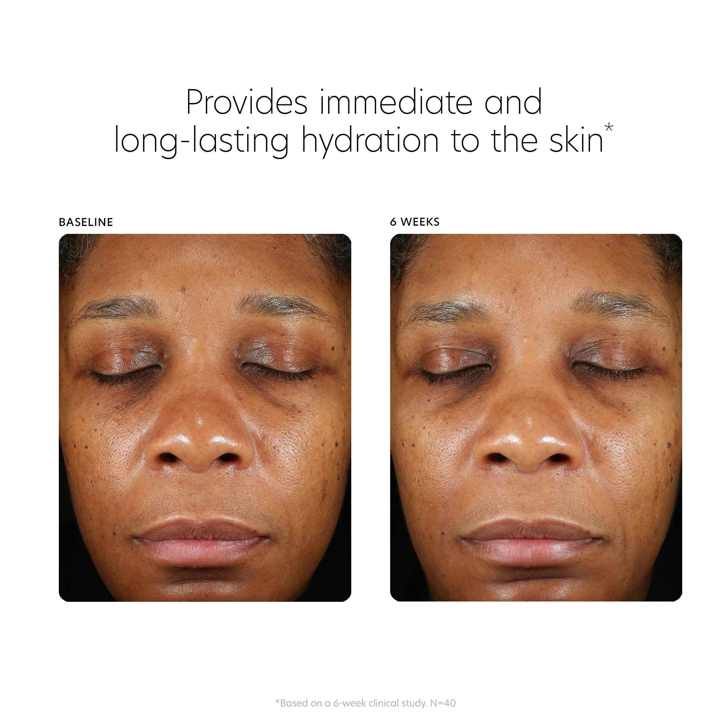 Foto 6 pulgar | Sérum Pca Skin De Ácido Hialurónico Para Rostro Y Antienvejecimiento, 90 Ml - Venta Internacional.