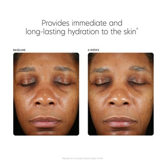 Foto 5 | Sérum Pca Skin De Ácido Hialurónico Para Rostro Y Antienvejecimiento, 90 Ml - Venta Internacional.