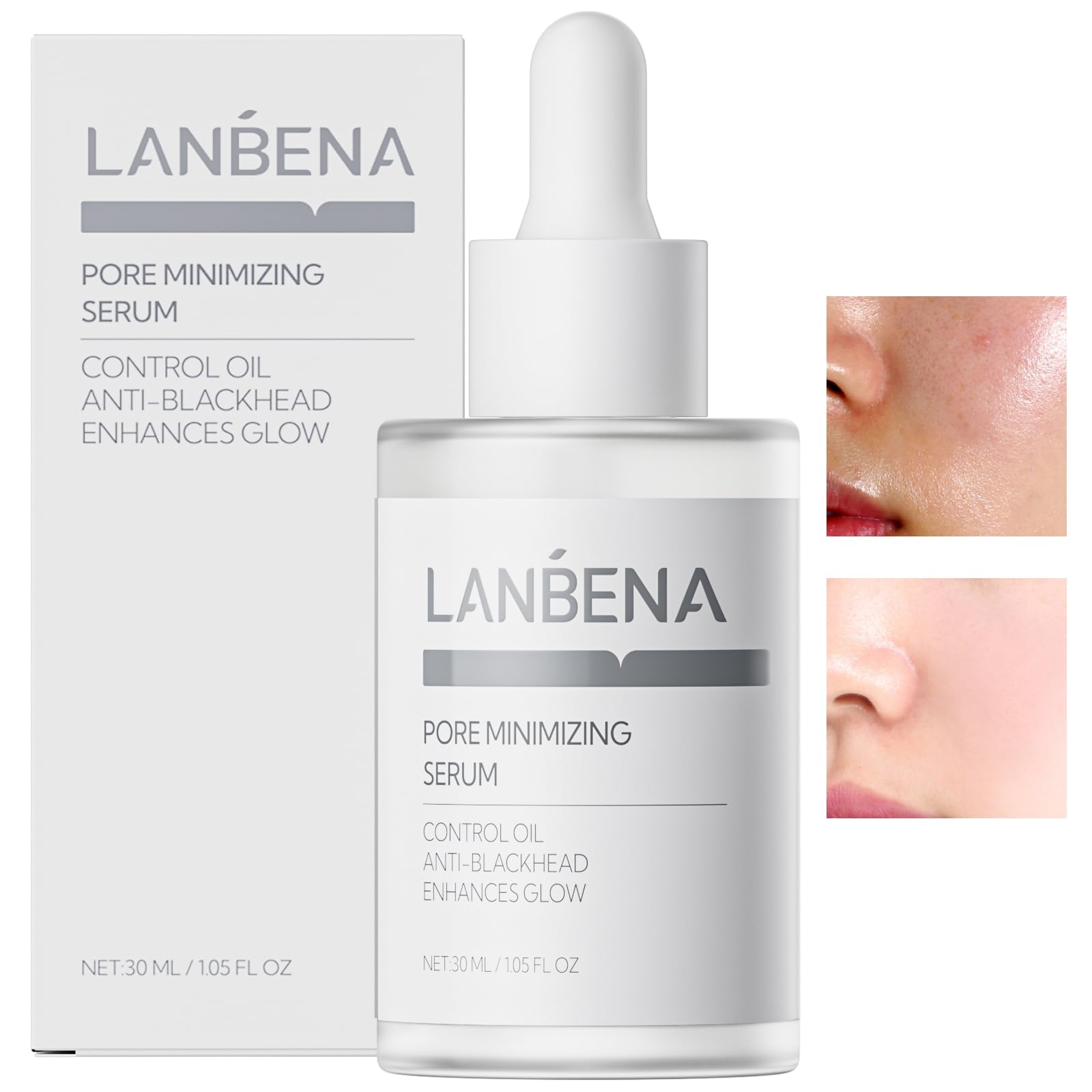 Foto 1 | Sérum Minimizador De Poros Lanbena 2.0 Treatment 30 Ml Para Rostro - Venta Internacional.