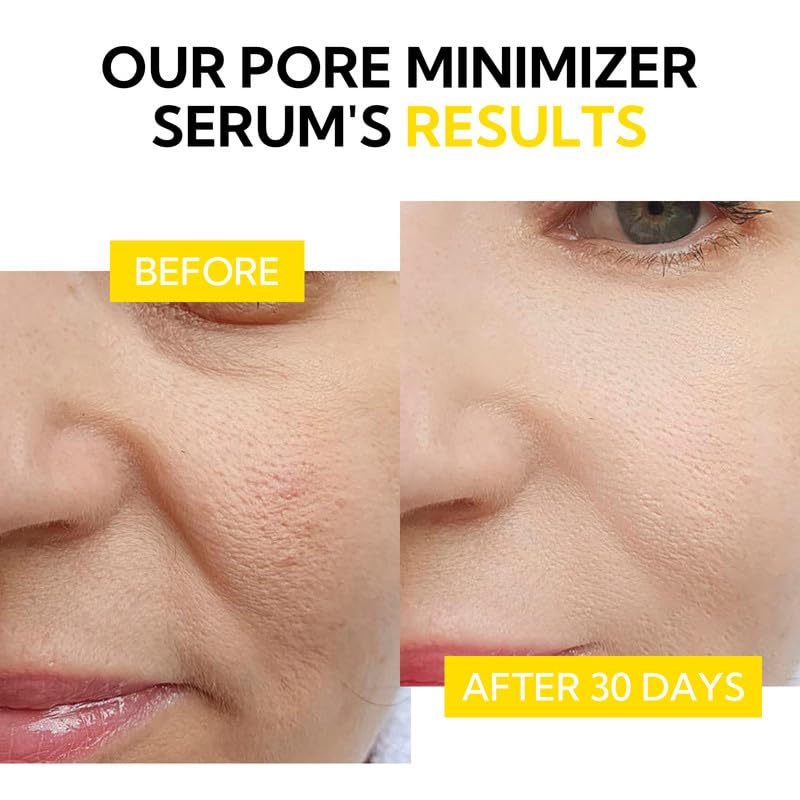 Foto 4 | Sérum Lanbena, Minimizador Y Reductor De Poros Para Rostro, 15 Ml, 100% Vegano - Venta Internacional.