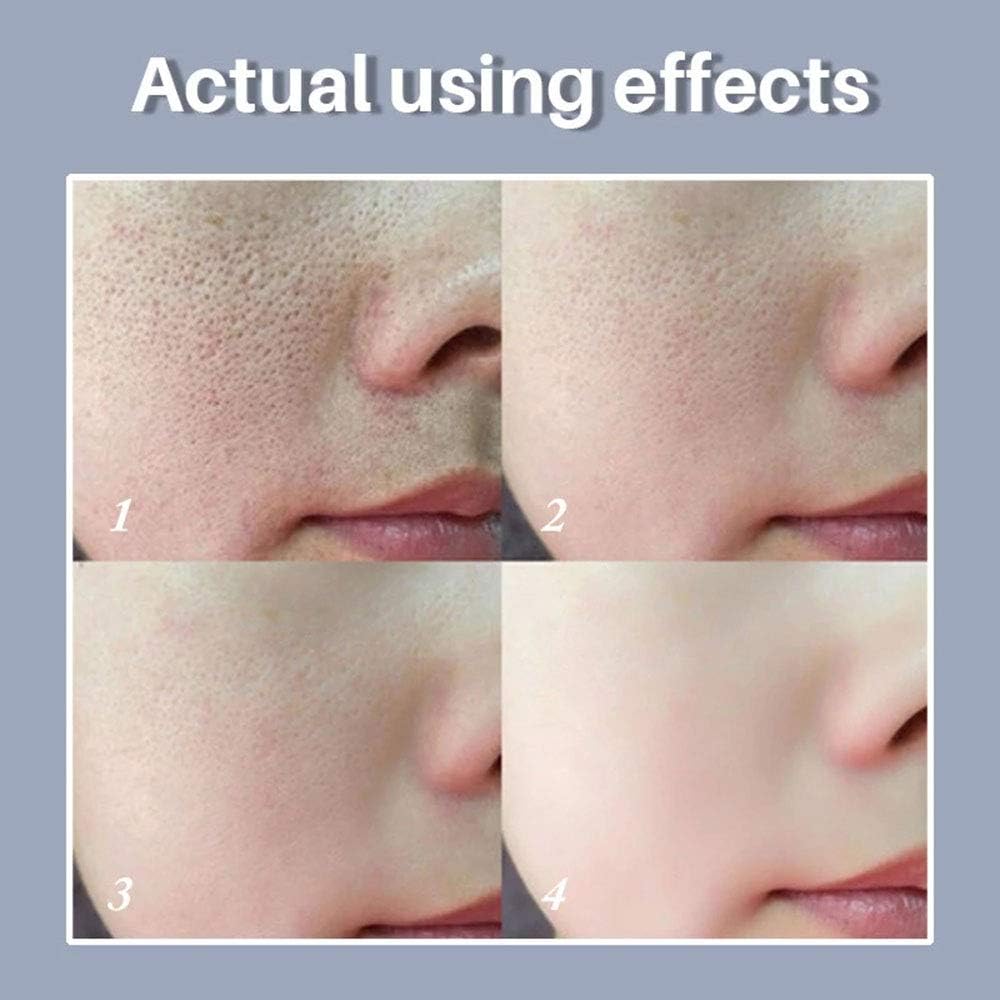 Foto 4 | Sérum Lanbena Esencia Facial Para El Cuidado De Los Poros, 15 Ml - Venta Internacional.