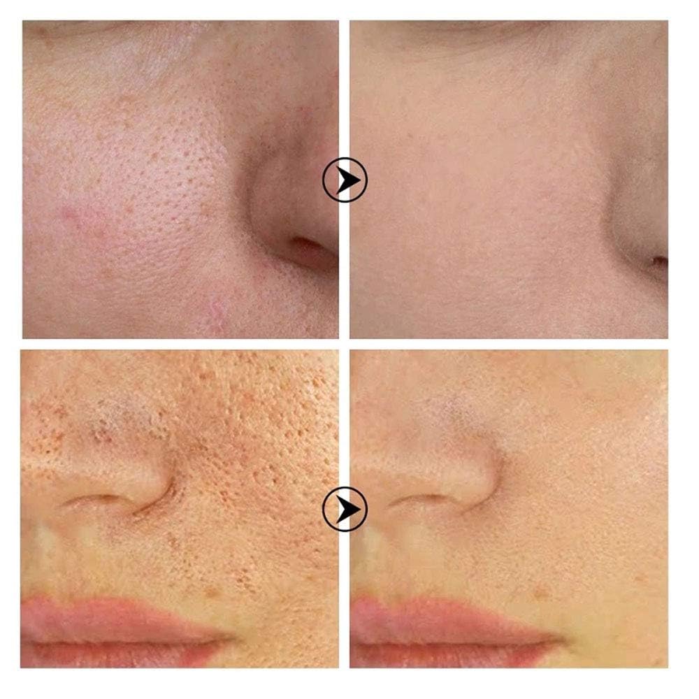 Foto 7 pulgar | Sérum Lanbena Esencia Facial Para El Cuidado De Los Poros, 15 Ml - Venta Internacional.
