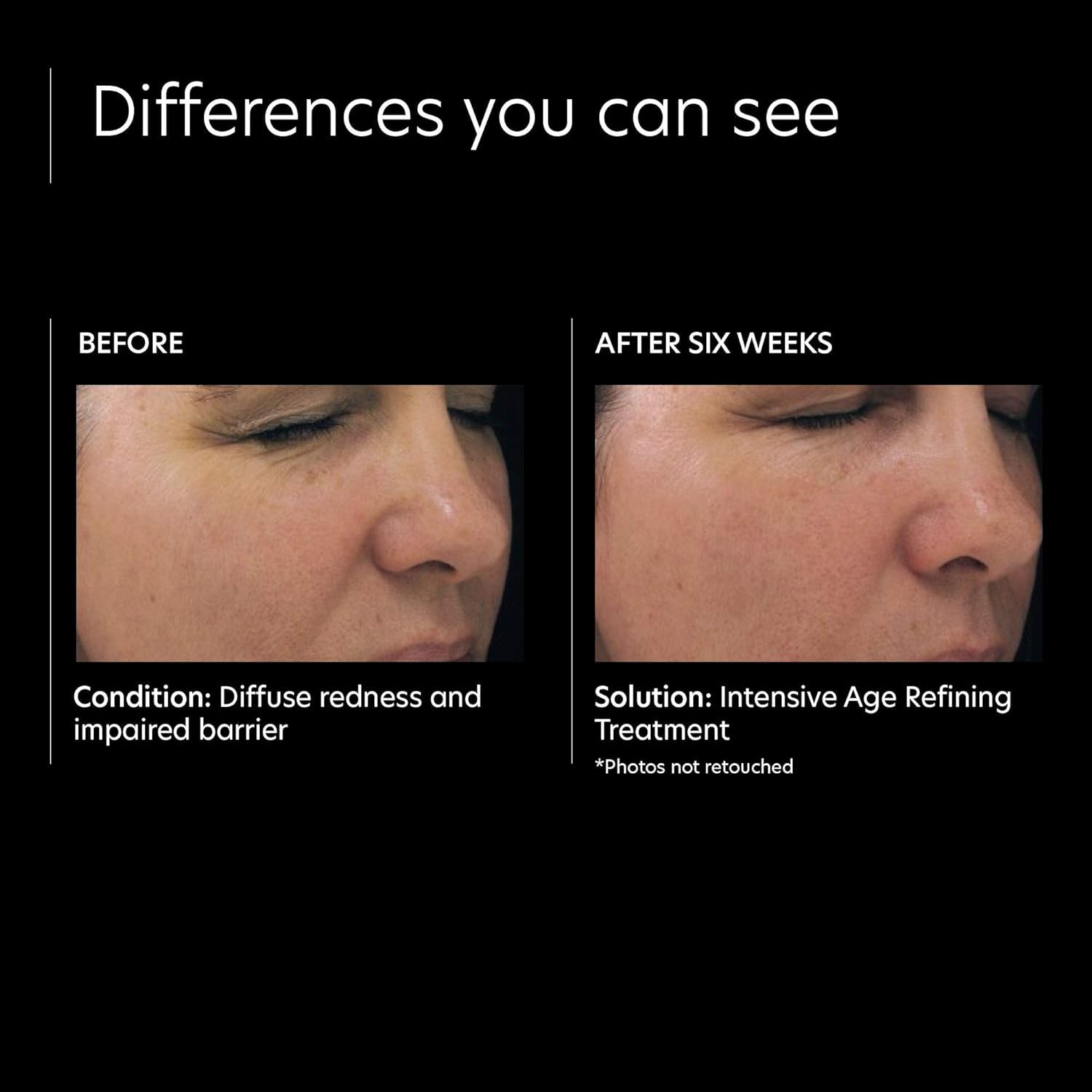 Foto 5 pulgar | Sérum Pca Skin Intensive Antienvejecimiento Con Retinol 0,5% 30 Ml - Venta Internacional.