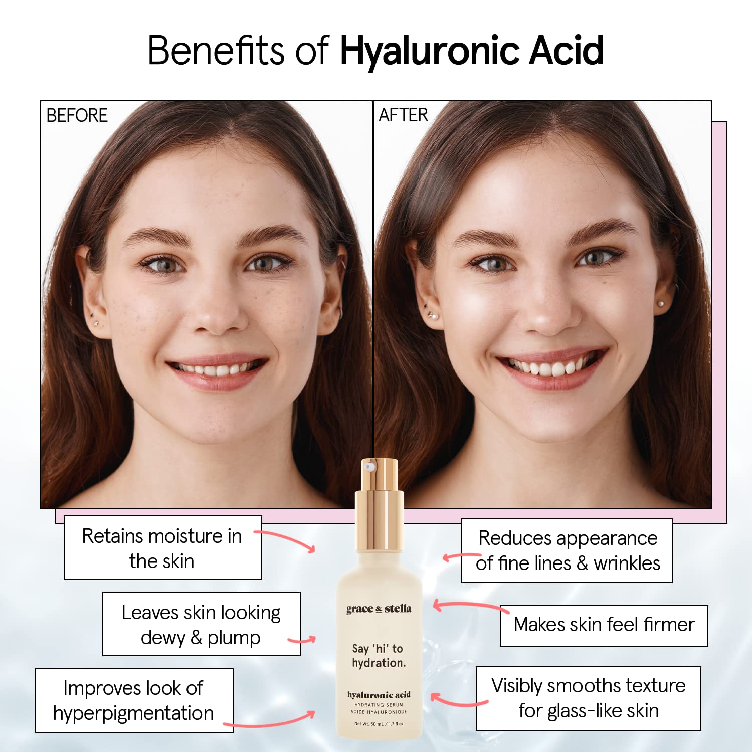 Foto 4 pulgar | Sérum De Ácido Hialurónico Grace & Stella, 50 Ml, Antiedad, Vegano - Venta Internacional.