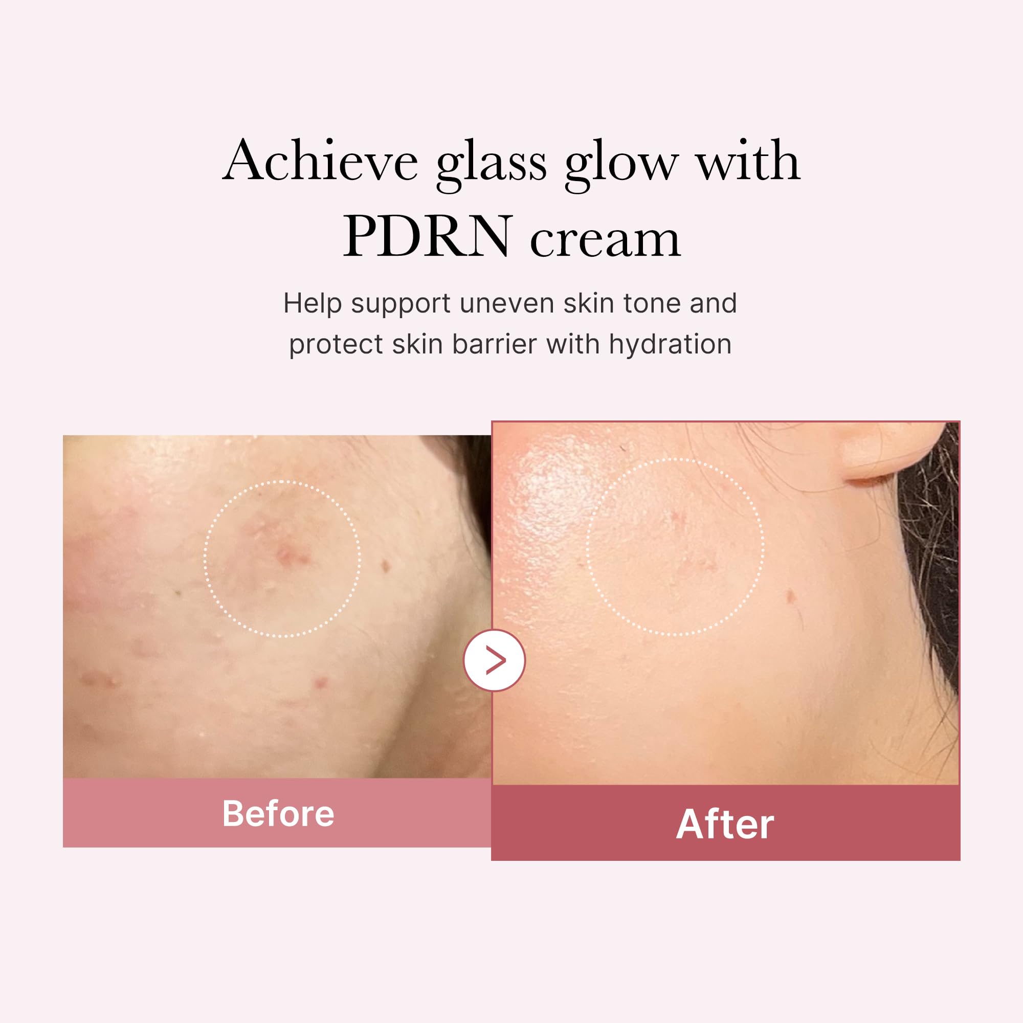Foto 4 pulgar | Crema Hidratante Medicube Pdrn Pink Con Niacinamida 50 Ml - Venta Internacional.