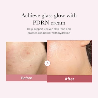 Foto 3 | Crema Hidratante Medicube Pdrn Pink Con Niacinamida 50 Ml - Venta Internacional.