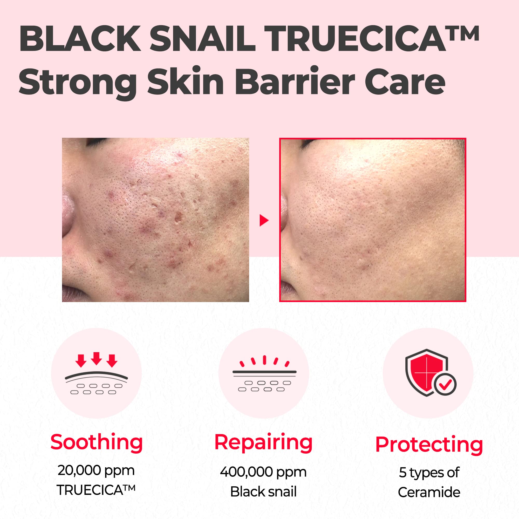 Foto 4 pulgar | Crema Hidratante Some By Mi Snail Truecica 60 g - Venta Internacional