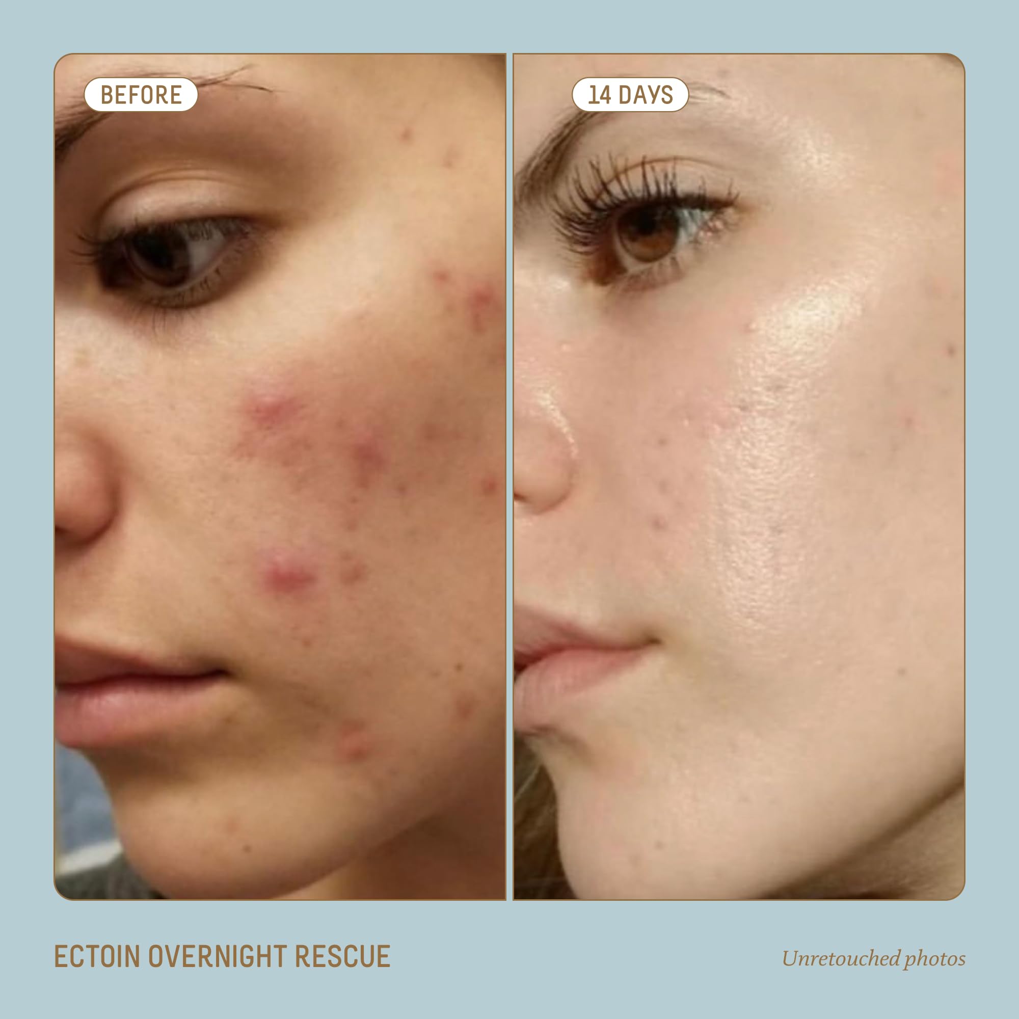 Foto 3 | Tratamiento Para El Cuidado De La Piel Biossance Squalane + Ectoin 50ml - Venta Internacional.
