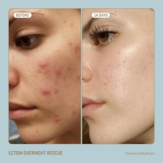 Foto 3 | Tratamiento Para El Cuidado De La Piel Biossance Squalane + Ectoin 50ml - Venta Internacional.