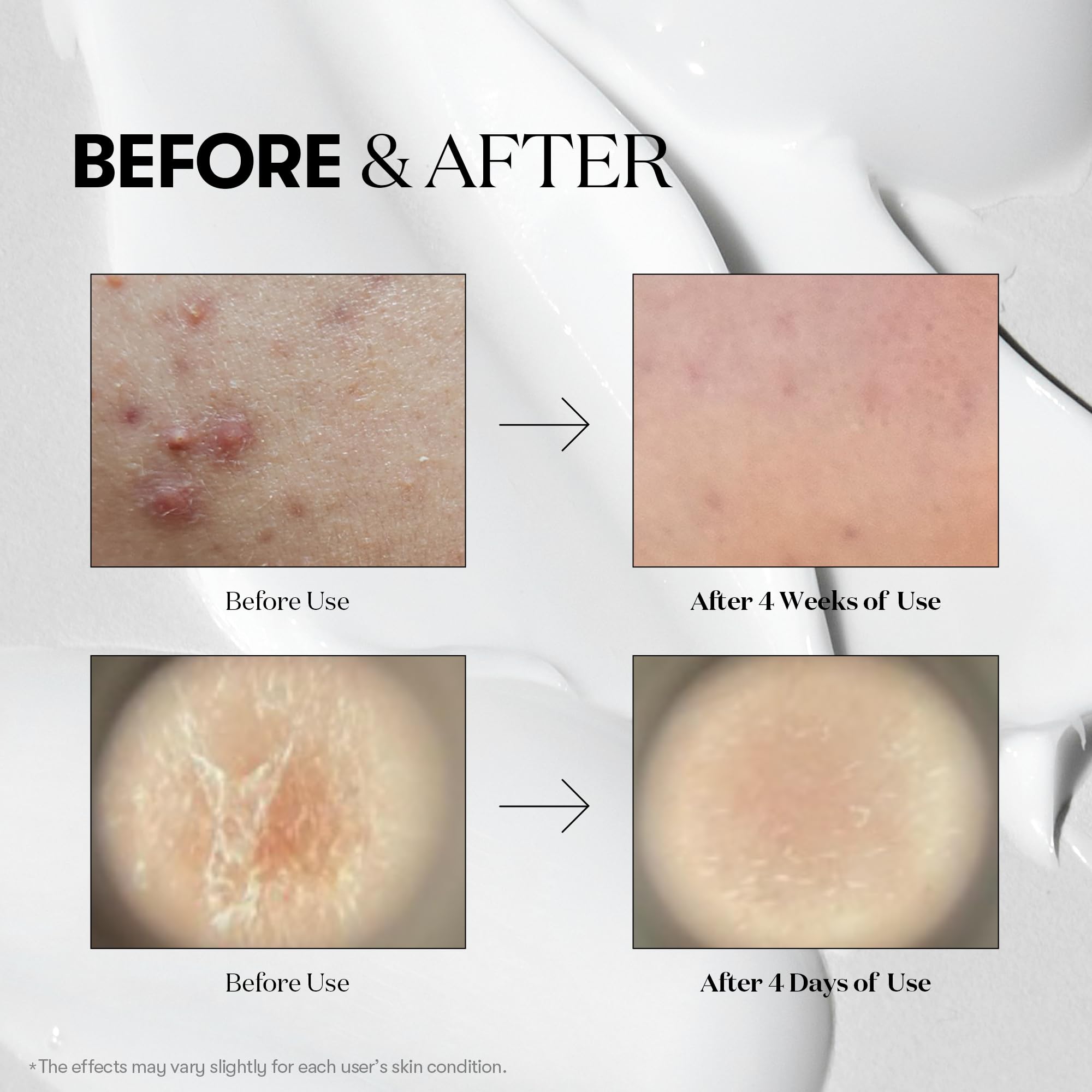 Foto 5 | Set Duo Reedle Shot 100 De Skincare Vt Cosmetics Con Colágeno Y Retinol - Venta Internacional.