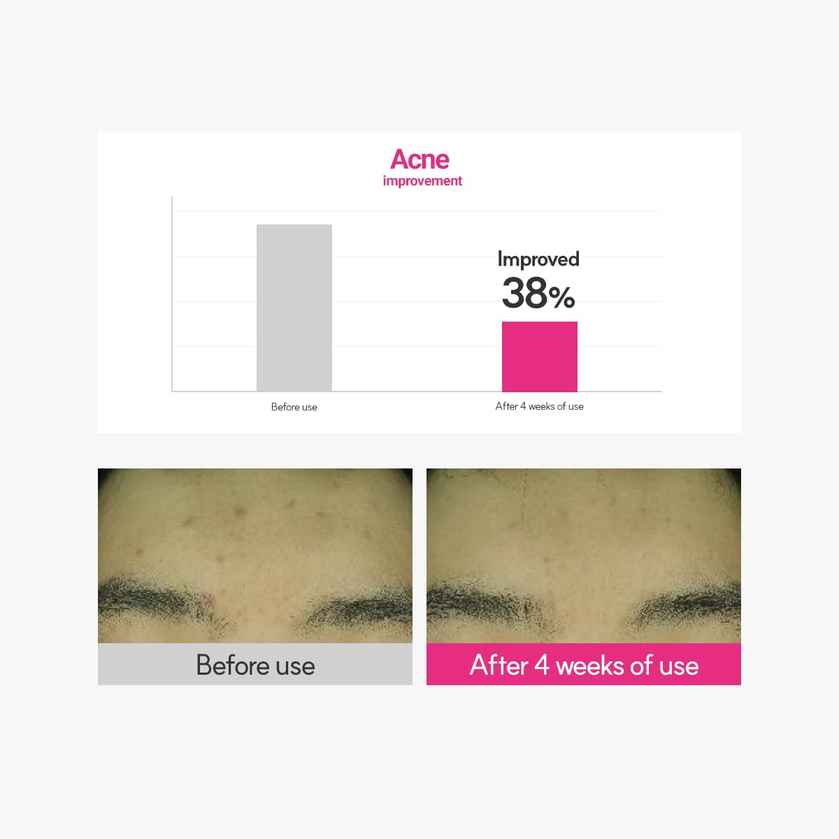 Foto 7 | Crema Hidratante Rovectin Cica Care Para Eliminar Imperfecciones, 50 Ml - Venta Internacional.