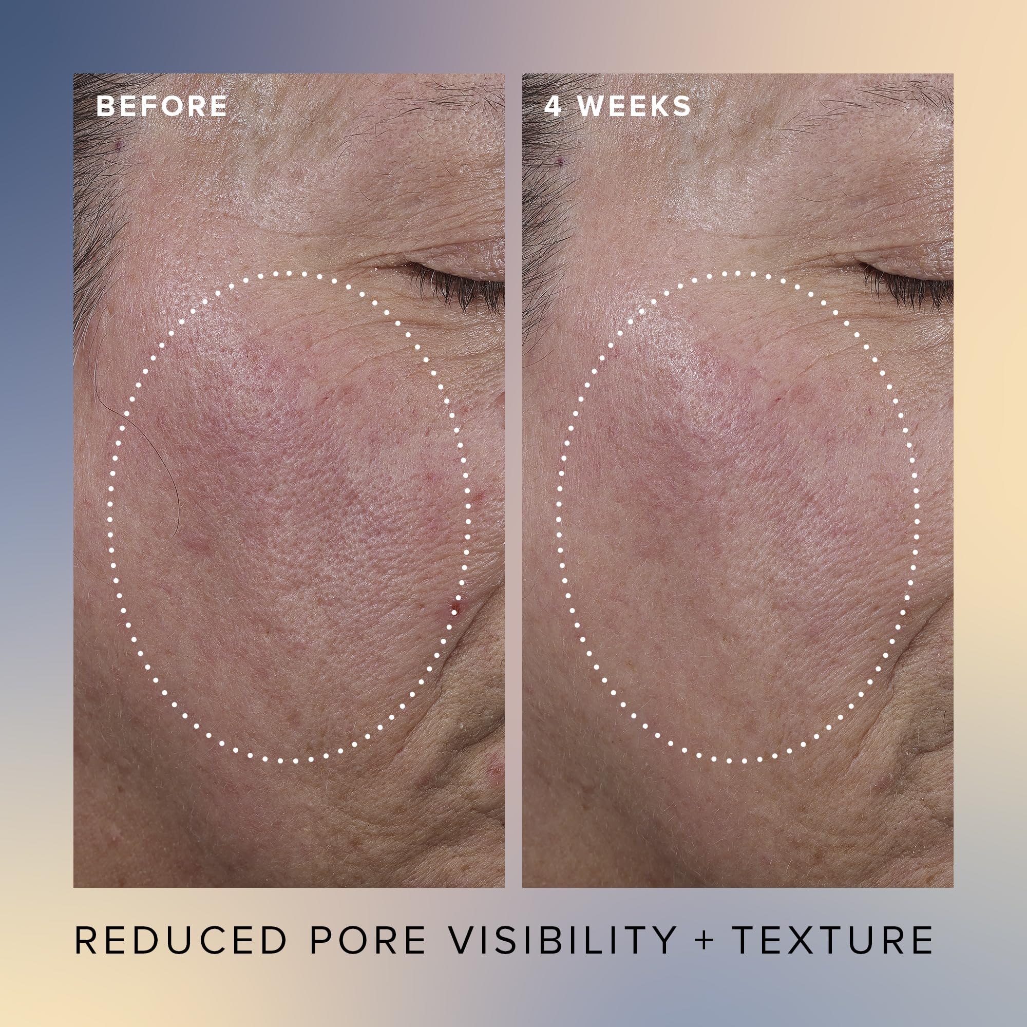 Foto 4 | Sérum Exfoliante Farmacy Honey Glow 17% Aha + Bha 30 Ml - Venta Internacional.