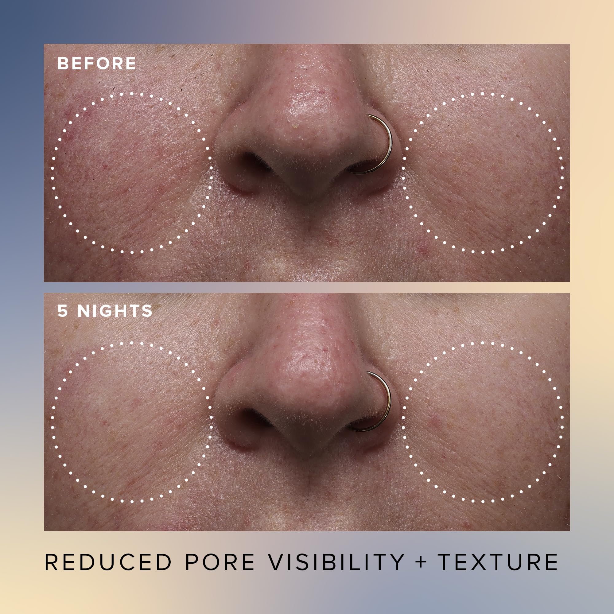 Foto 6 pulgar | Sérum Exfoliante Farmacy Honey Glow 17% Aha + Bha 30 Ml - Venta Internacional.