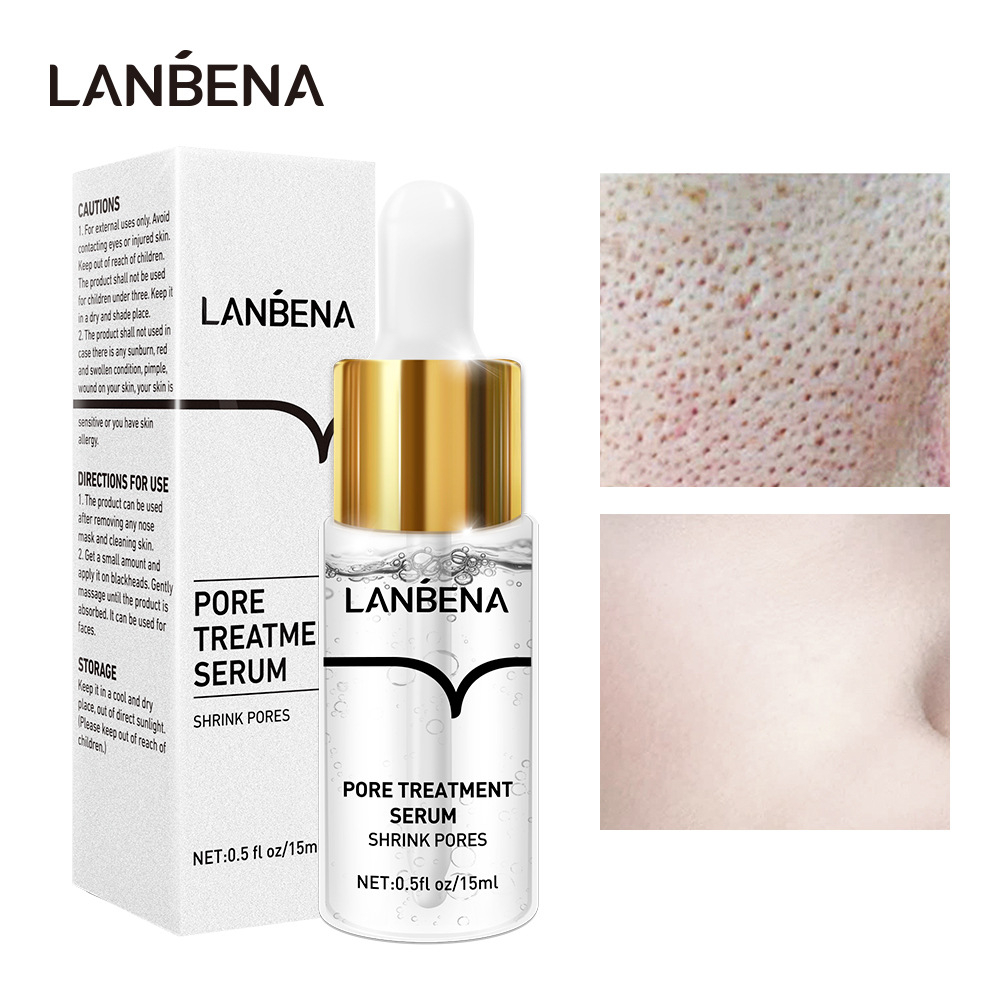 Foto 1 | Lanbena Contração De Porto La-10 - Venta Internacional.