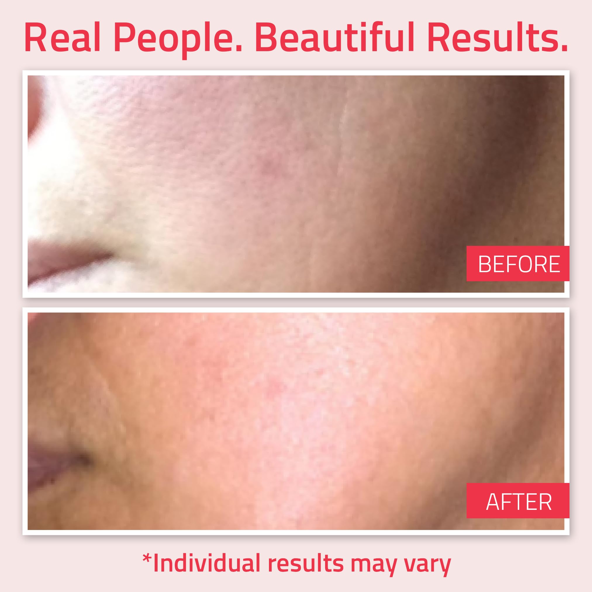 Foto 5 pulgar | Crema Hidratante De Retinol Yeouth Para Rostro 30 Ml Con Ácido Hialurónico - Venta Internacional.