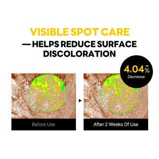 Foto 5 | Crema Round Lab Vita Niacinamida Dark Spot 50 Ml Para El Cuidado De La Piel Coreano - Venta Internacional.