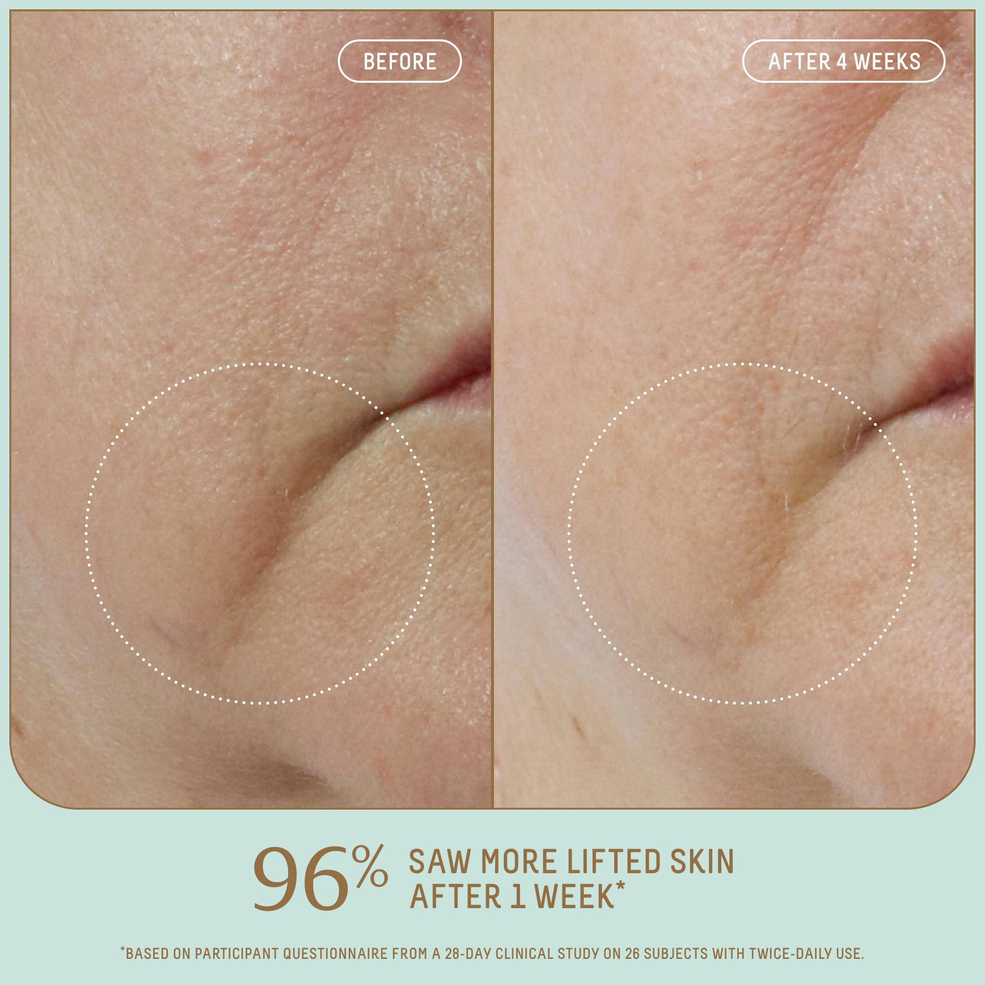 Foto 3 pulgar | Sérum Facial Biossance Squalane + Firm & Lift 30 Ml Para Pieles Maduras - Venta Internacional.