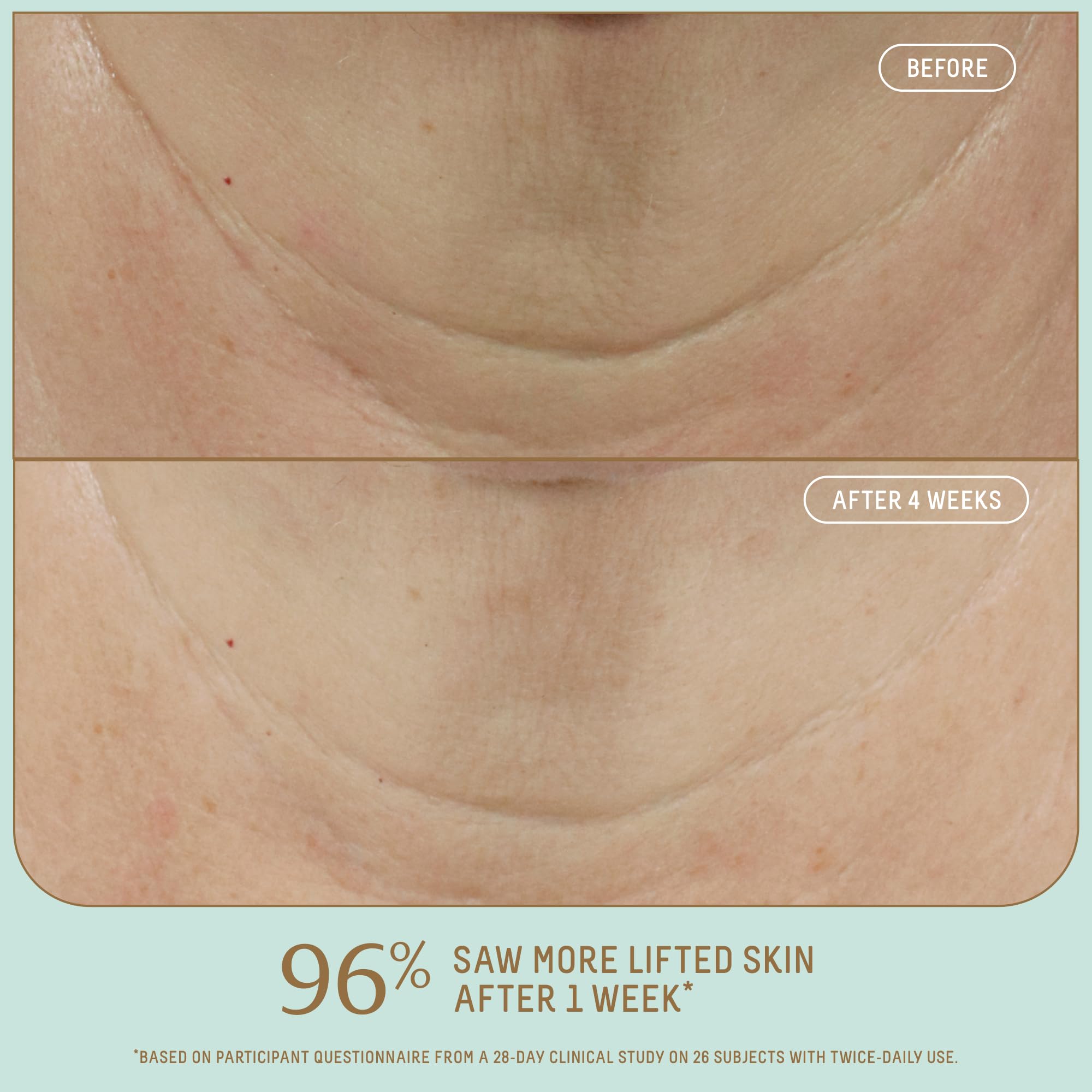Foto 4 pulgar | Sérum Facial Biossance Squalane + Firm & Lift 30 Ml Para Pieles Maduras - Venta Internacional.