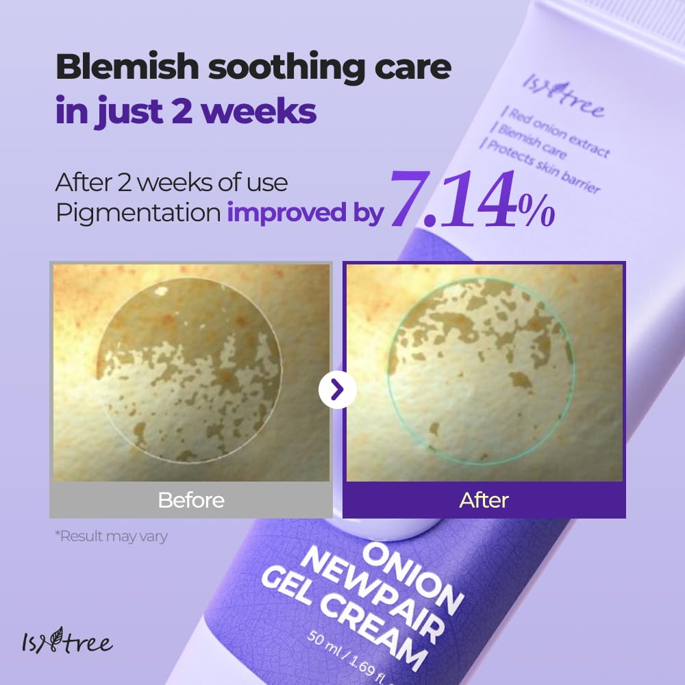 Foto 5 pulgar | Crema En Gel Sintree Onion Newpair De 50 Ml Con Tratamiento Para Imperfecciones - Venta Internacional.
