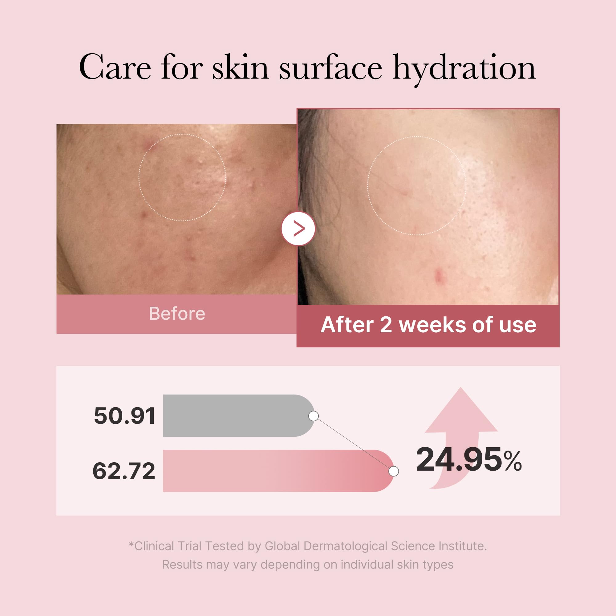 Foto 2 | Sérum En Aerosol Medicube Salmon Dna Pdrn Con Glutatión Rosa, 100 Ml - Venta Internacional.