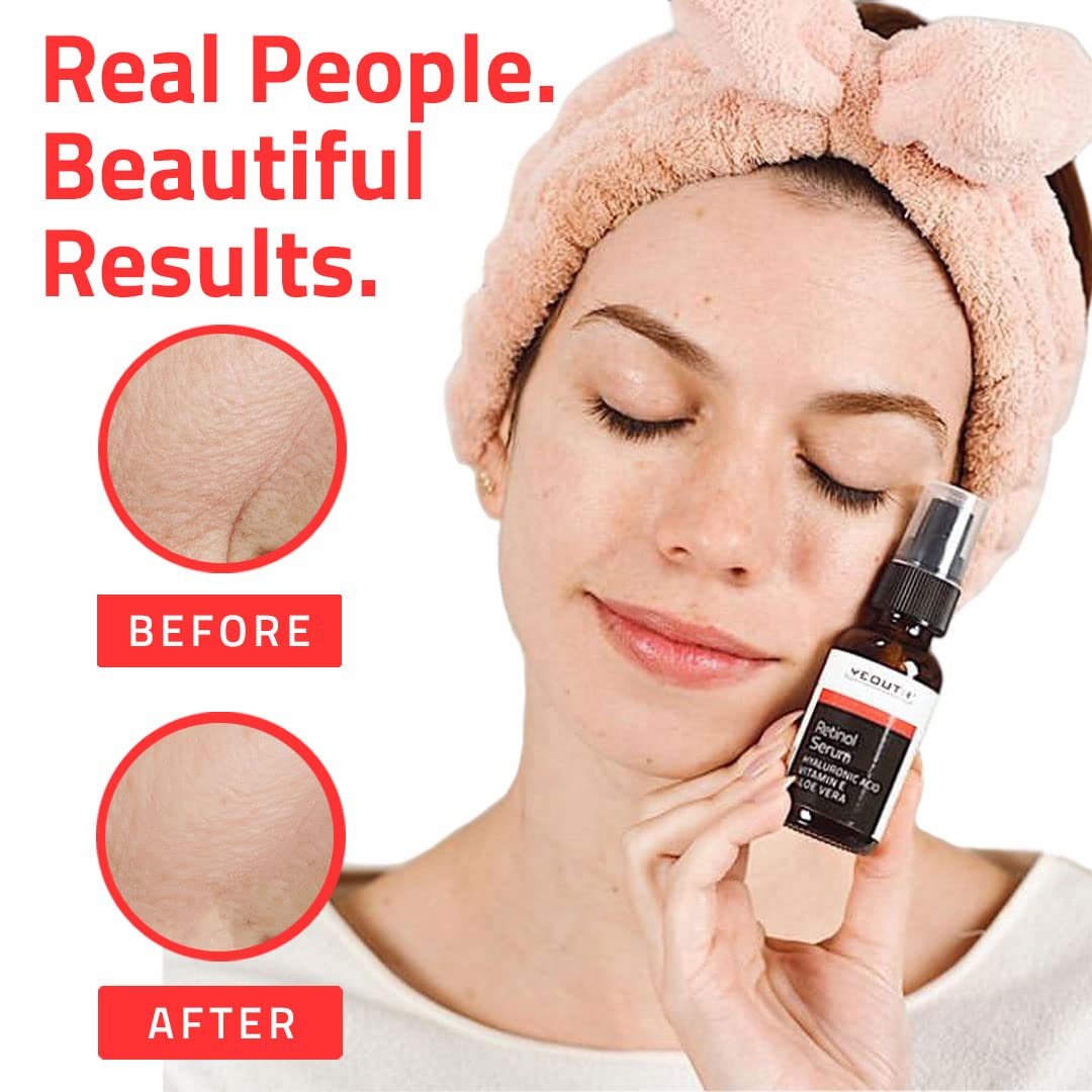 Foto 7 pulgar | Sérum Yeouth Retinol Con Ácido Hialurónico 30 Ml Antienvejecimiento - Venta Internacional.