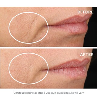 Foto 5 | Sérum Facial Strivectin Advanced Retinol Concentrado 30 Ml - Venta Internacional.