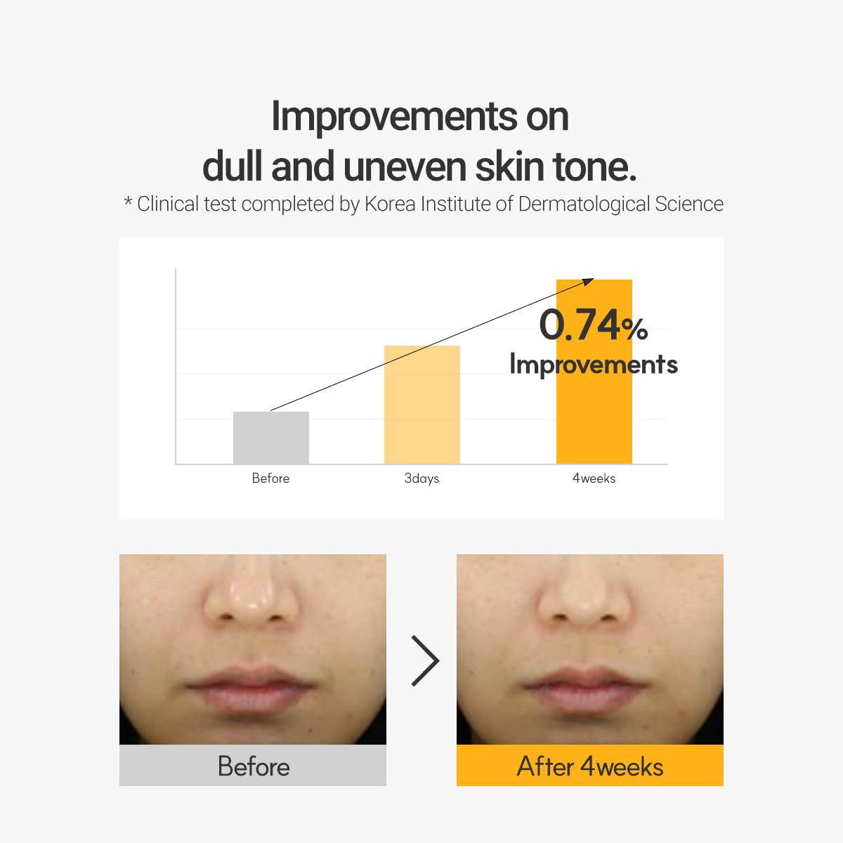 Foto 7 pulgar | Sérum Rovectin Vita Para Eliminar Manchas Oscuras Y Tono De Piel  30 Ml - Venta Internacional.