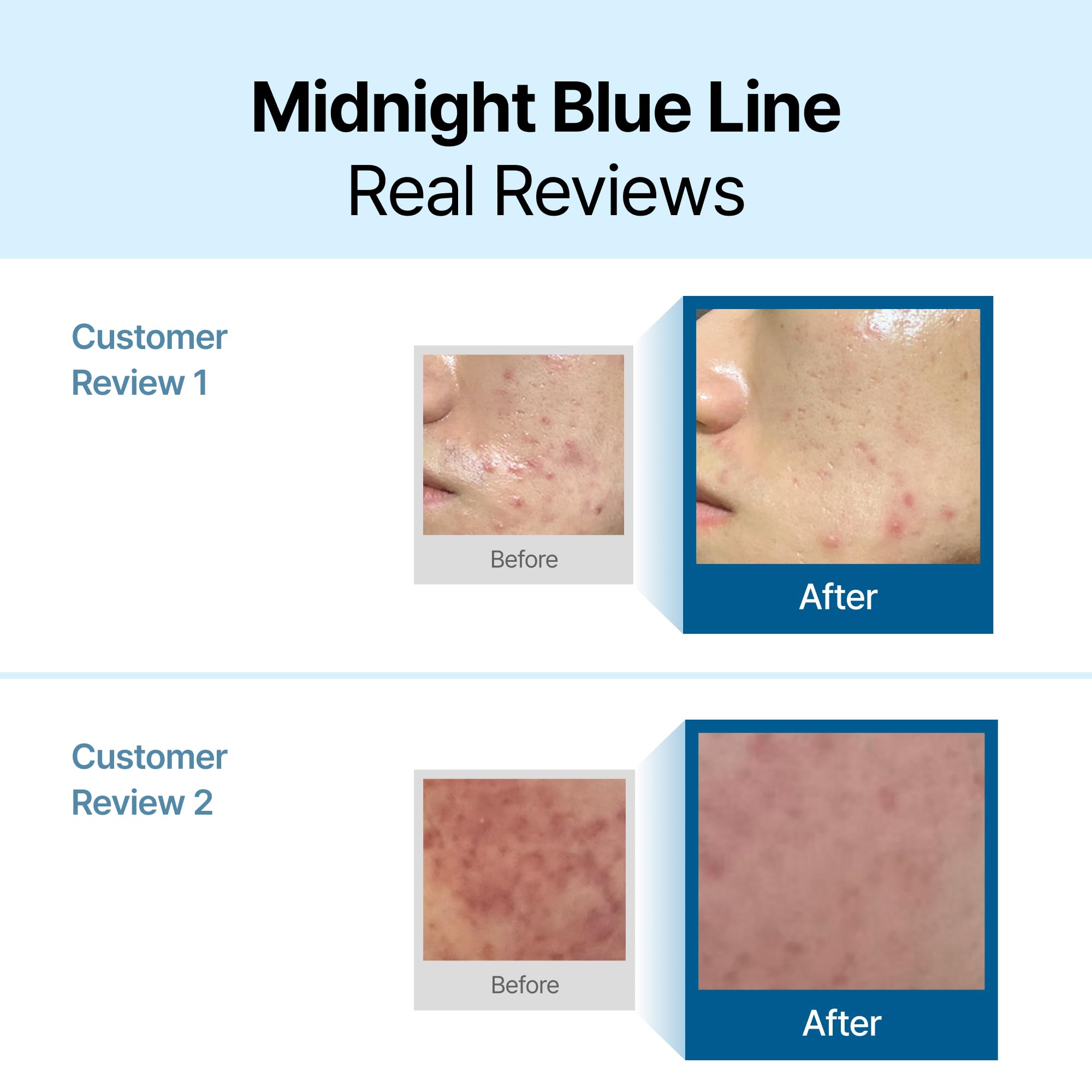 Foto 3 pulgar | Crema Calmante Dearklairs Midnight Blue 30 Ml - Venta Internacional.