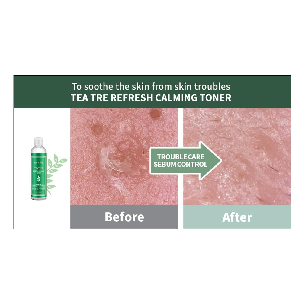 Foto 6 pulgar | Árbol De Té Calmante Toner Secret Key Refresh 248 Ml - Venta Internacional.