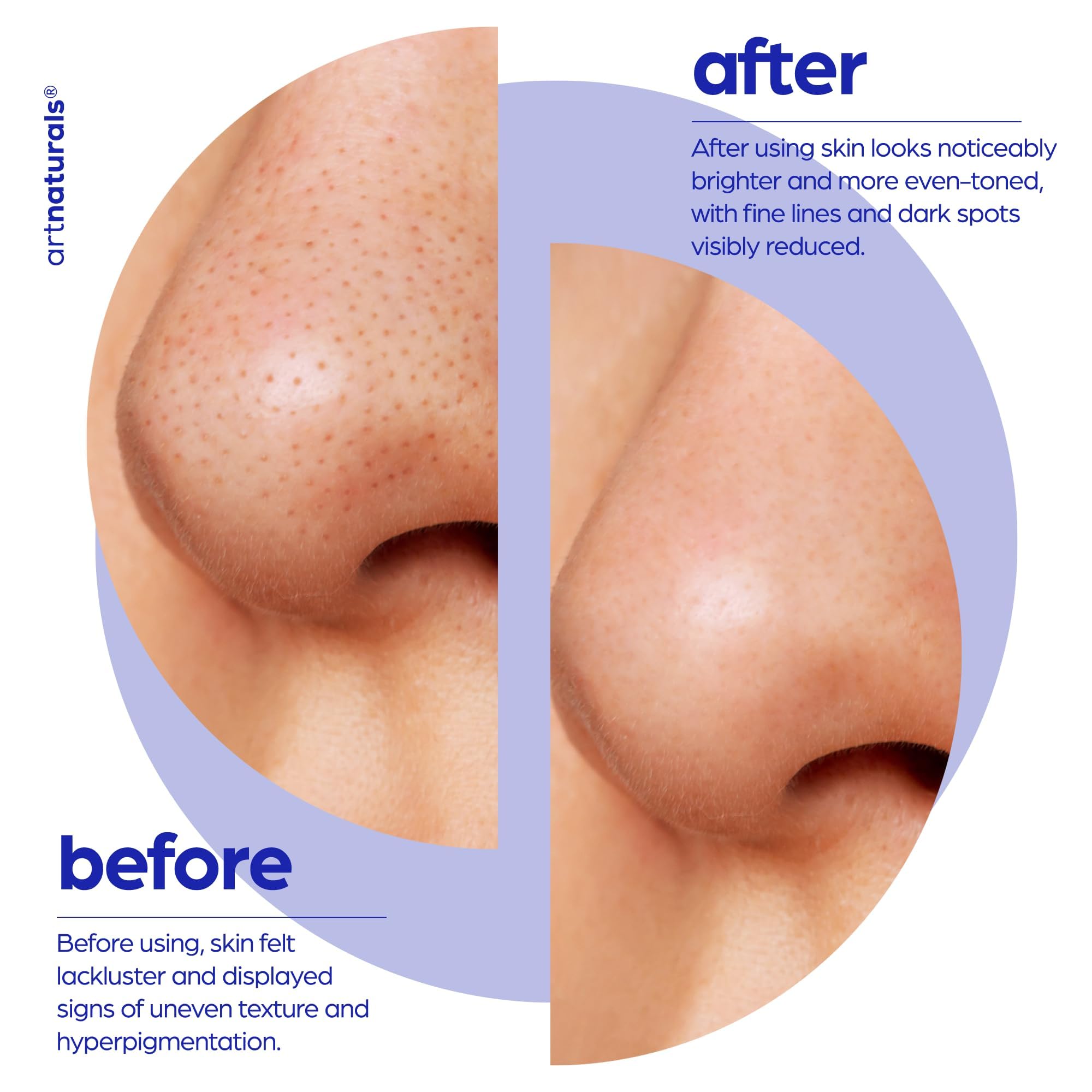 Foto 7 pulgar | Sérum Glicólico Serum Artnaturals 30 Ml Con Vitamina C Y Aloe - Venta Internacional.