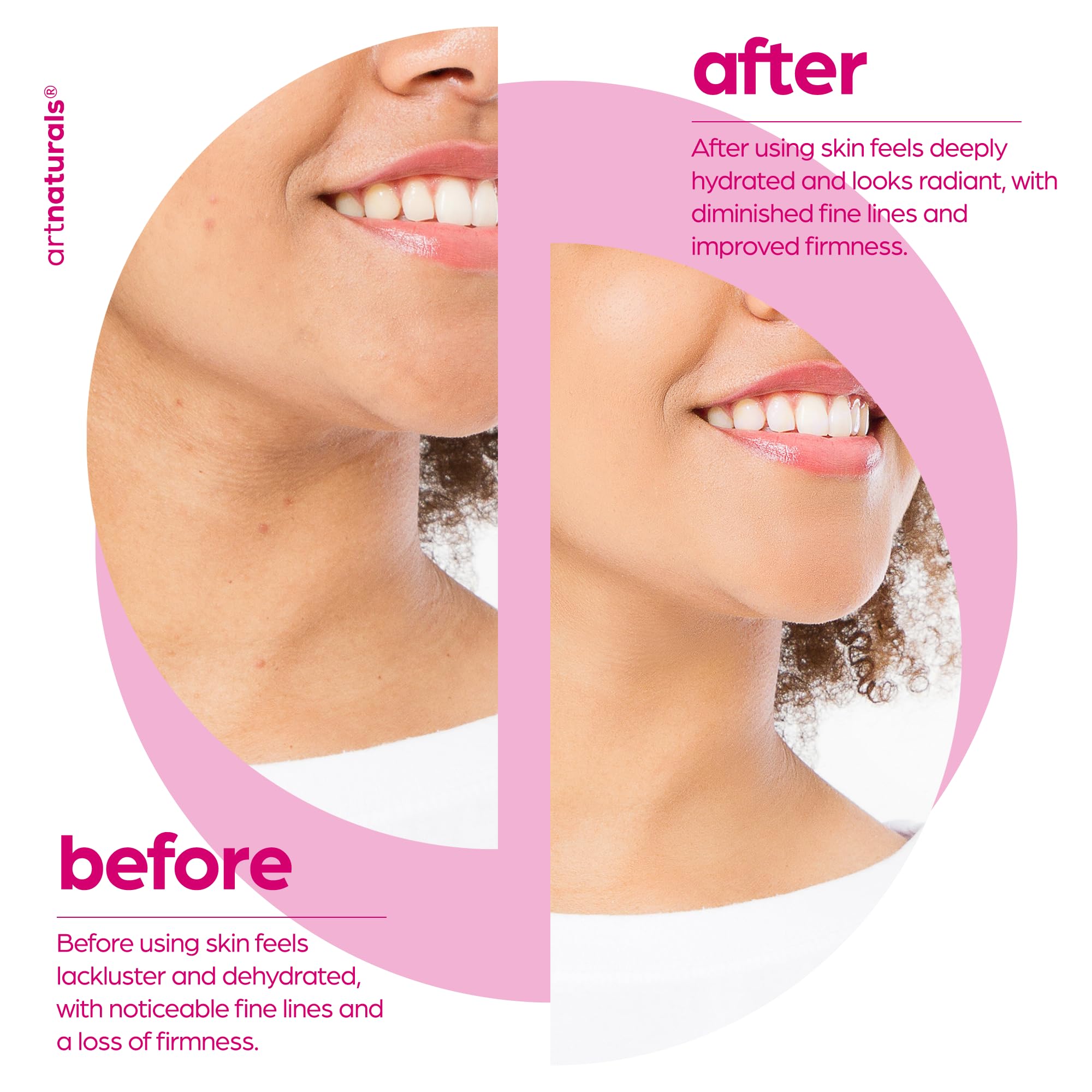 Foto 7 pulgar | Serum Artnaturals Colágeno Potenciador Para Rostro  30 Ml  Con Ácido Hialurónico Y Vitamina E - Venta Internacional.