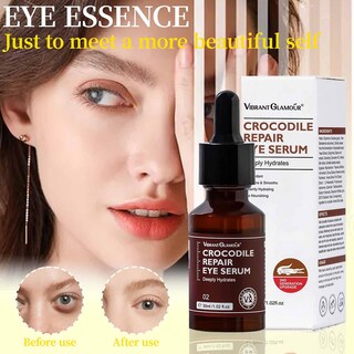 Foto 2 | Sérum Para Ojos Huoguo De Segunda Generación Que Reduce Las Ojeras 30 Ml - Venta Internacional.
