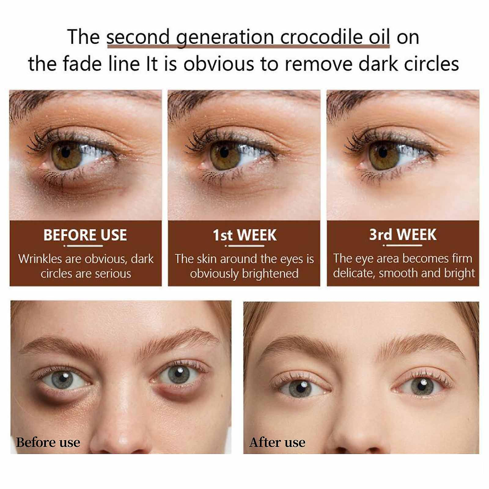 Foto 5 pulgar | Sérum Para Ojos Huoguo De Segunda Generación Que Reduce Las Ojeras 30 Ml - Venta Internacional.