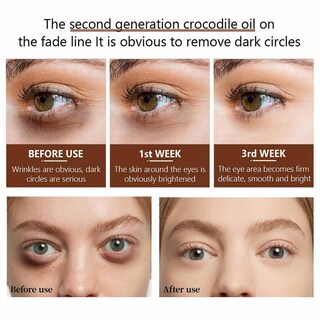 Foto 4 | Sérum Para Ojos Huoguo De Segunda Generación Que Reduce Las Ojeras 30 Ml - Venta Internacional.