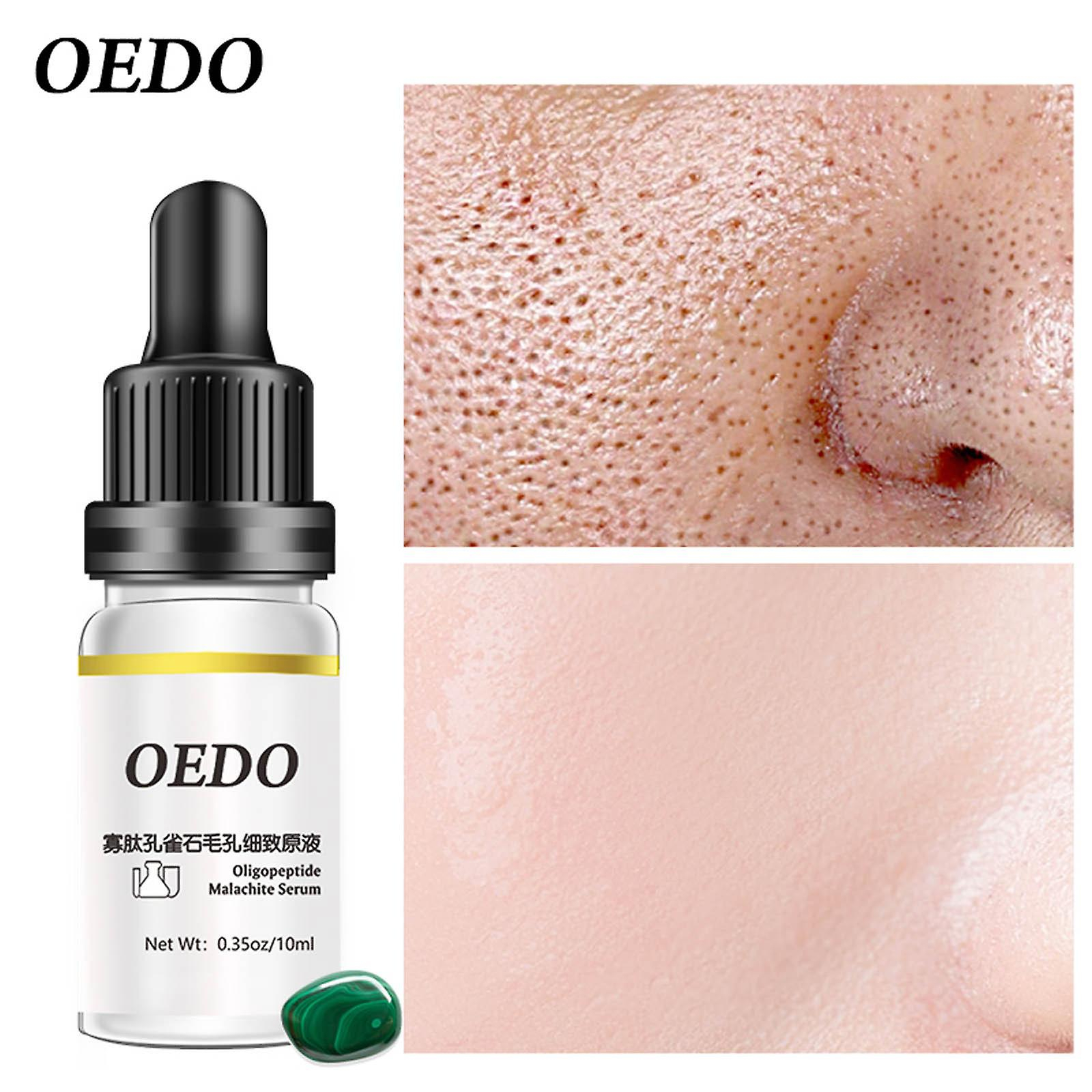Foto 5 pulgar | Serum Essence Huoguo  Oligopéptido De Malaquita  10 Ml  Iluminador - Venta Internacional.