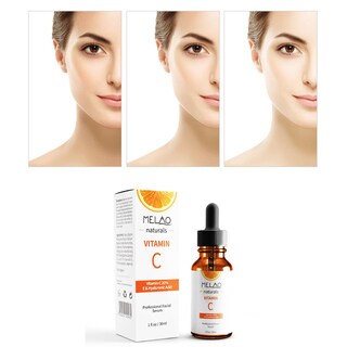 Foto 1 | Essence Huoguo Melao Vc Original Hidratante Y Reparador 30 Ml - Venta Internacional.