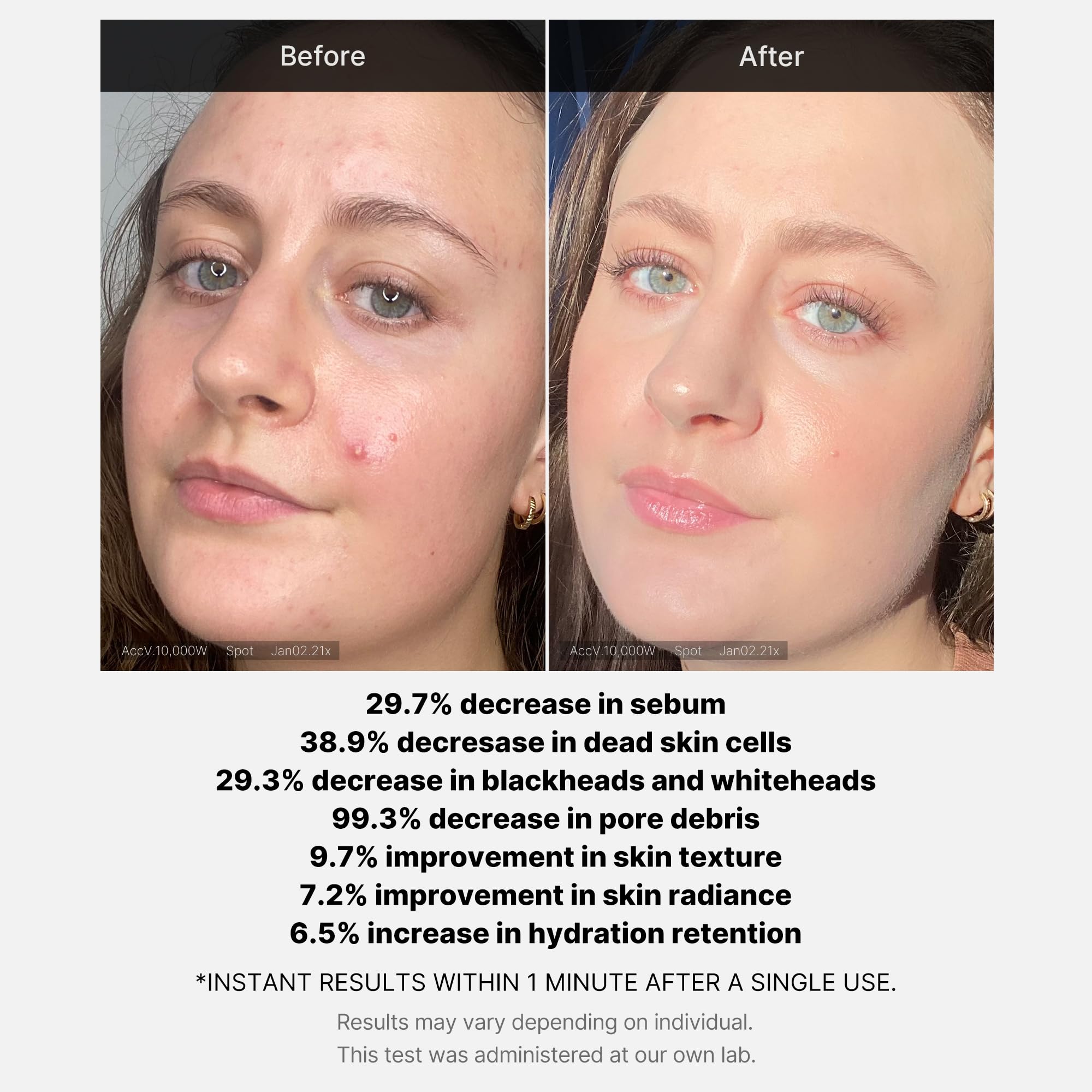 Foto 6 pulgar | Sérum Facial Medicube  Exfoliante Con Un 21% De Ácido (aha+bha) - Venta Internacional.