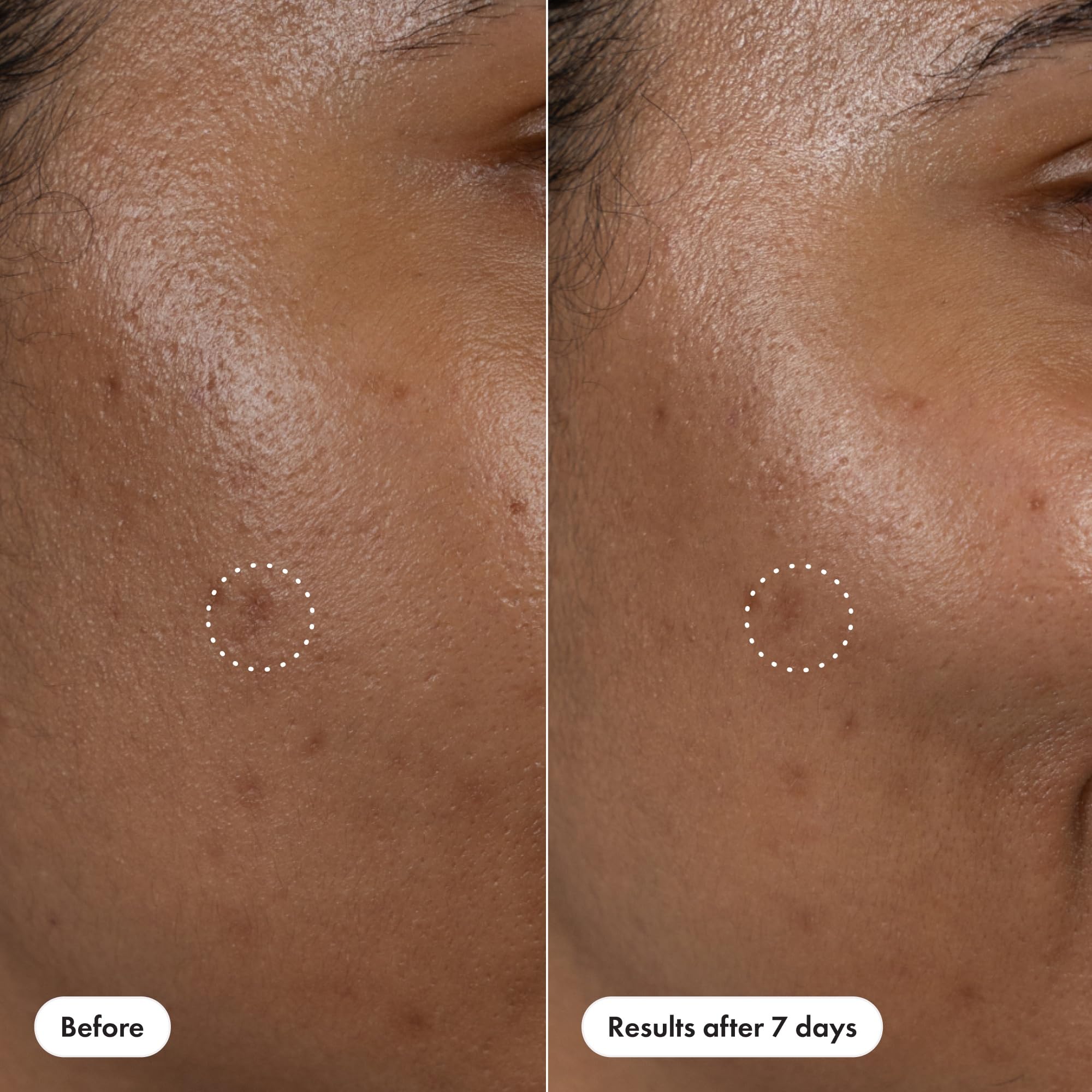 Foto 8 pulgar | Serum Hero Cosmetics  Corrector De Manchas Oscuras  15% De Vitamina C Y Ácido Hialurónico  10 Ml - Venta Internacional.
