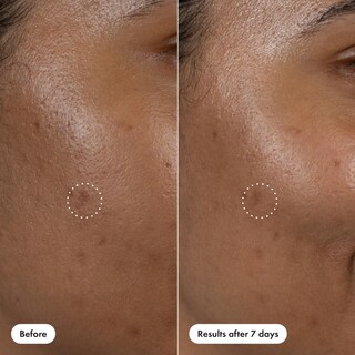 Foto 7 | Serum Hero Cosmetics Corrector De Manchas Oscuras 15% De Vitamina C Y Ácido Hialurónico 10 Ml - Venta Internacional.
