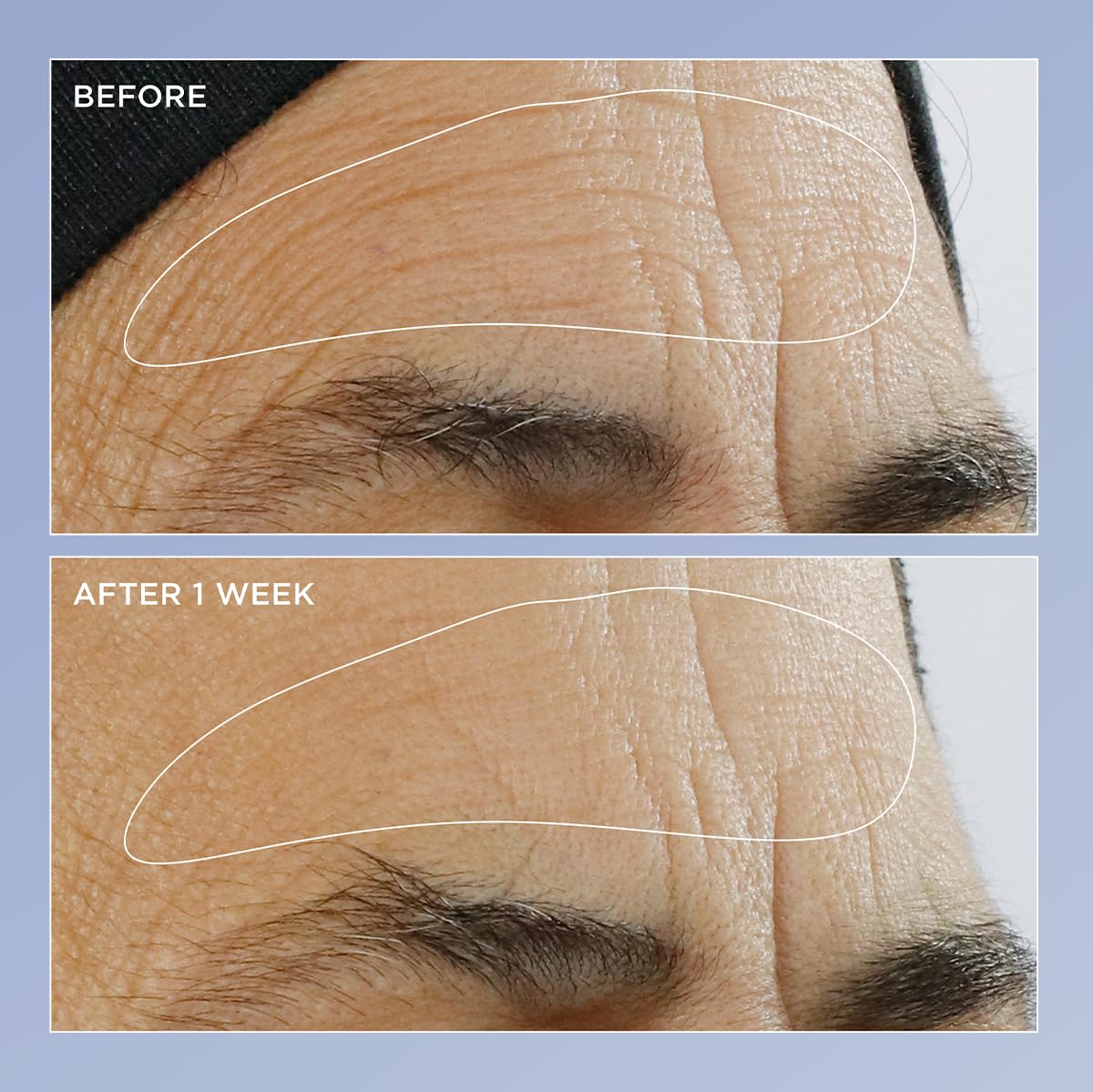 Foto 3 pulgar | Sérum Perricone Md De Alta Potencia Con Triple Renovación De Retinol  60 Ml - Venta Internacional.