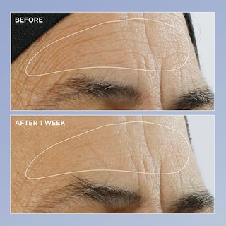 Foto 2 | Sérum Perricone Md De Alta Potencia Con Triple Renovación De Retinol 60 Ml - Venta Internacional.