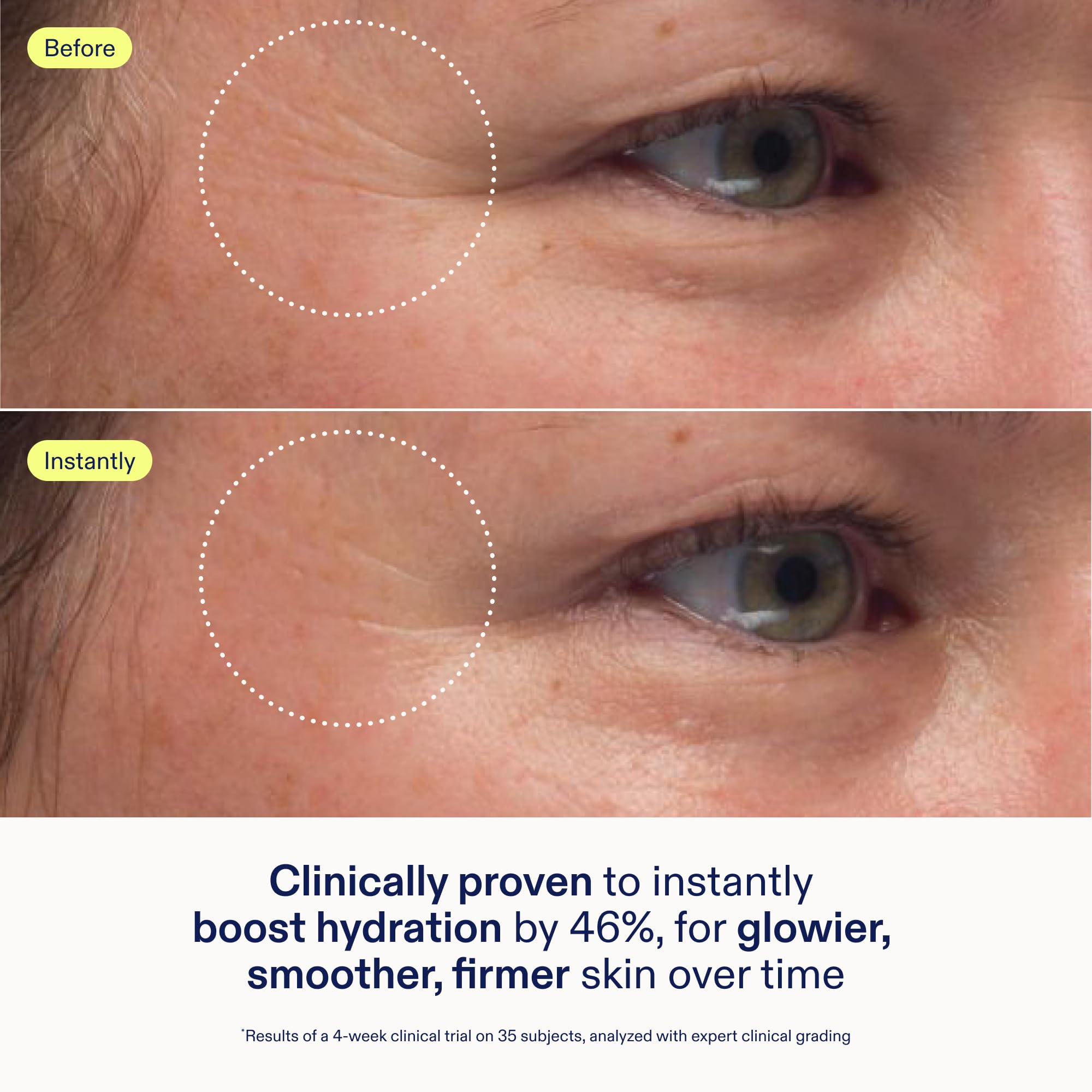 Foto 4 pulgar | Crema Hidratante Skinfix Triple Lipídico-péptido 15 Ml - Venta Internacional.