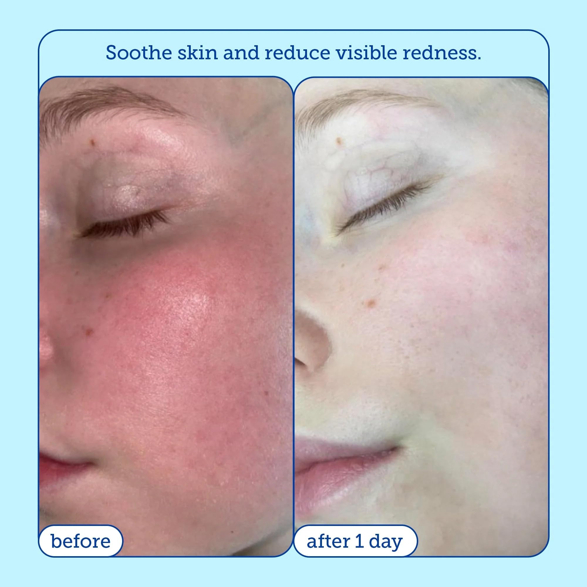 Foto 5 pulgar | Kit Skincare Skinfix Barrier+ Better Skin Con Minicrema  Limpiador Y Sérum - Venta Internacional.