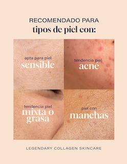 Foto 6 | Tonico Facial 500ml Niacinamida Colageno Skin Care Toner