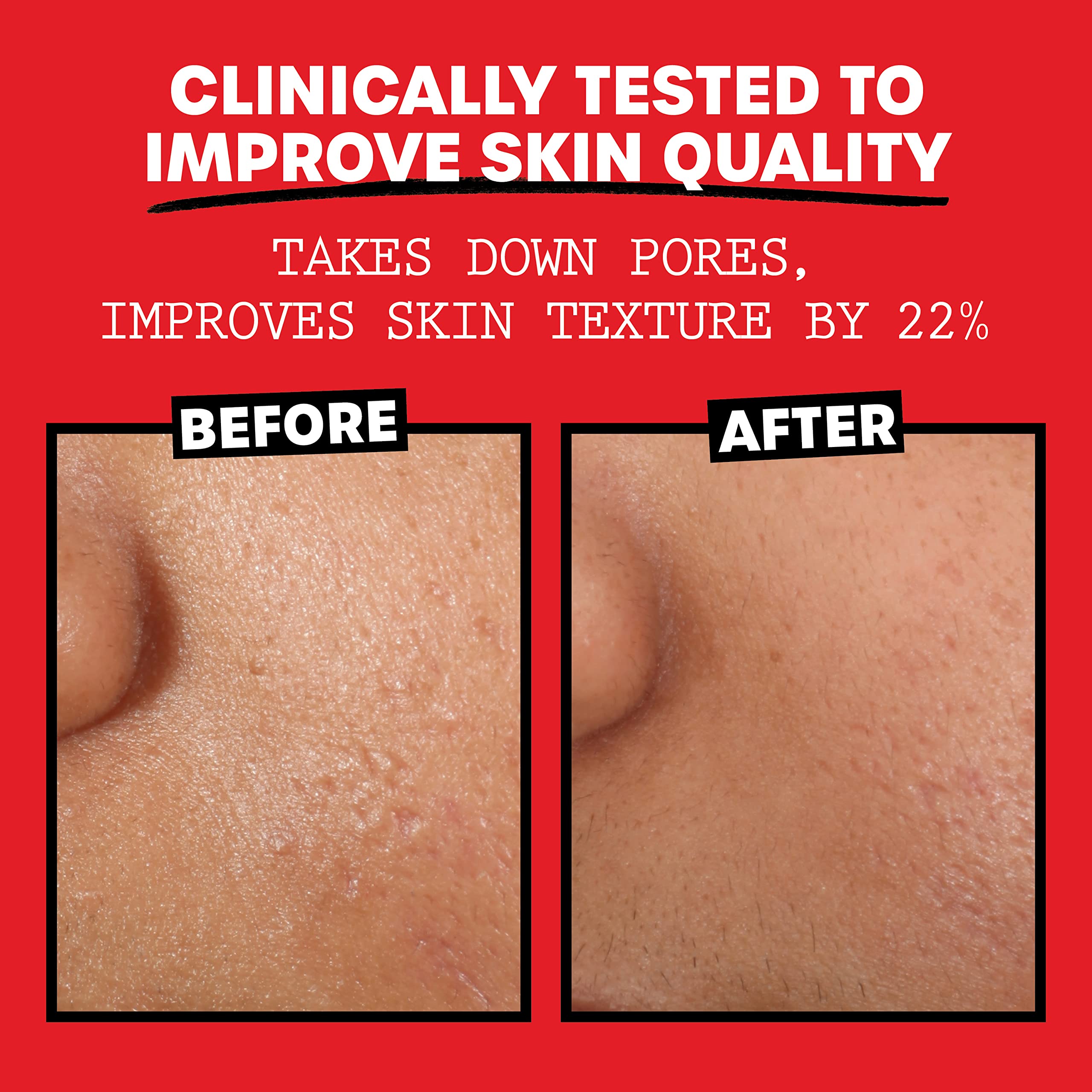 Foto 6 pulgar | Tónico Facial Thayers Sin Alcohol con Pétalos de Rosa y Hamamelis 250 Ml - Venta Internacional