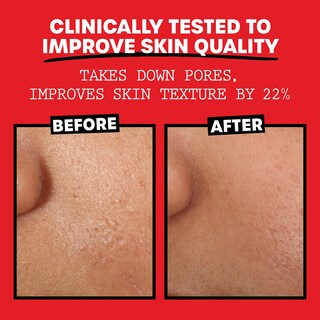 Foto 5 | Tónico Facial Thayers, Sin Alcohol, Pepino Y Hamamelis, 250 Ml, 2 Unidades - Venta Internacional.