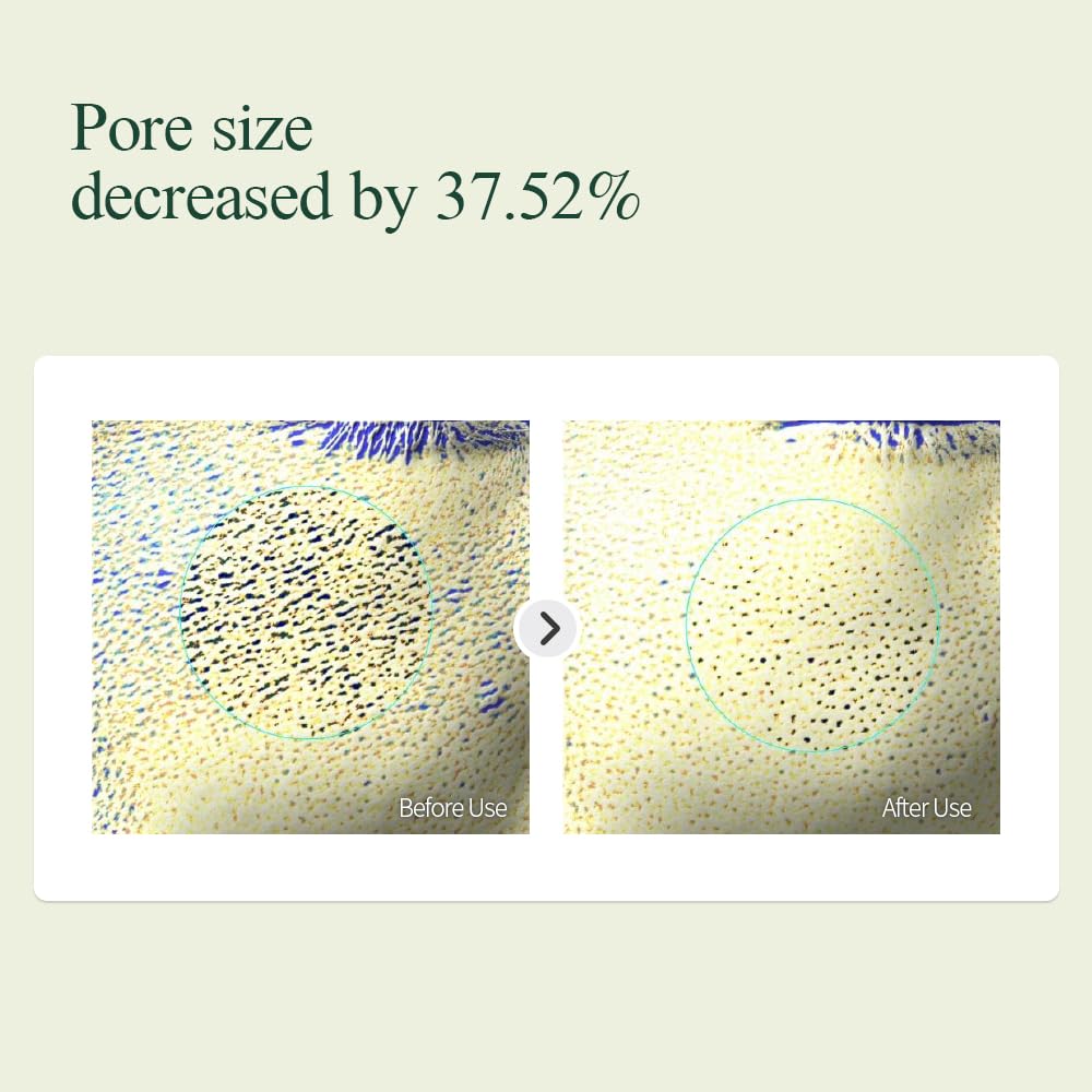 Foto 6 pulgar | Crema Hidratante Pyunkang Yul Calming 50 Ml Con Ceramidas - Venta Internacional.