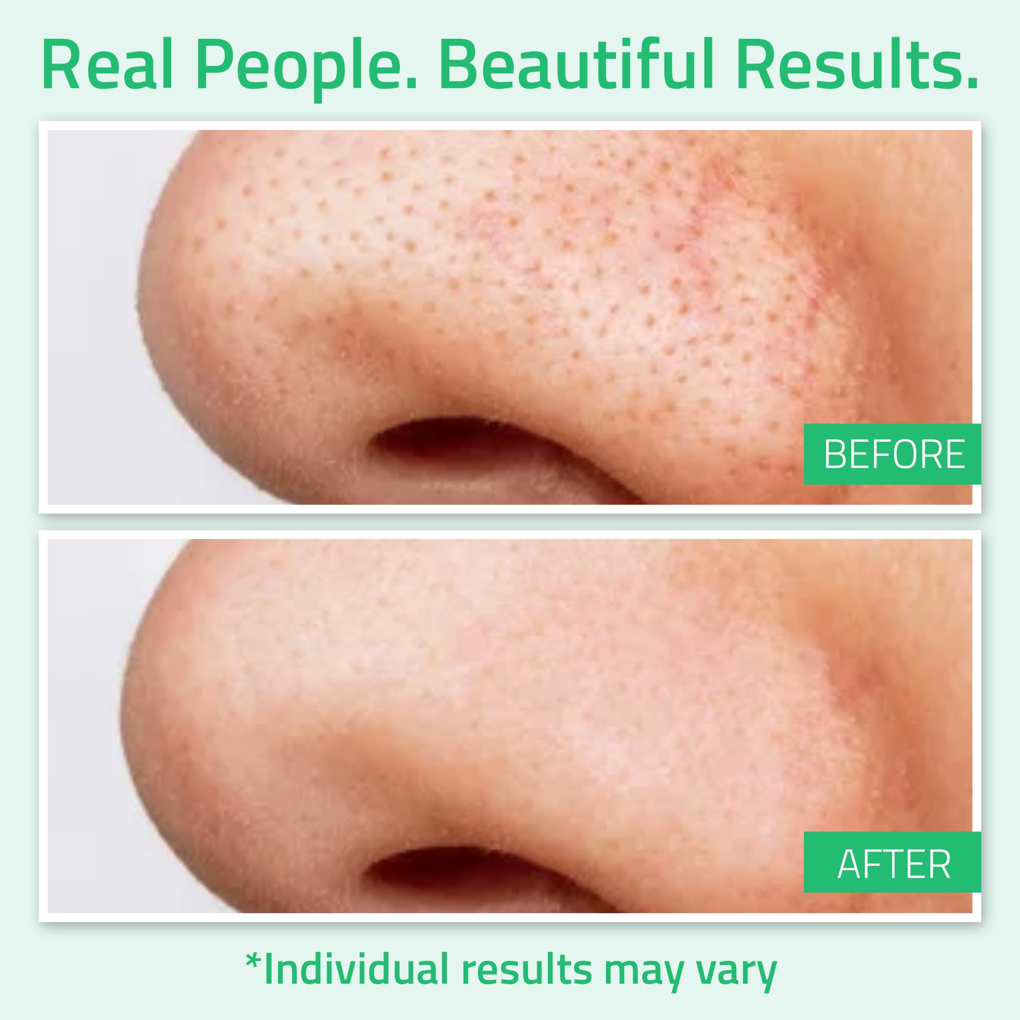 Foto 4 pulgar | Tónico Yeouth Ácido Glicólico 8% Con Hamamelis 180 Ml Para Rostro - Venta Internacional.