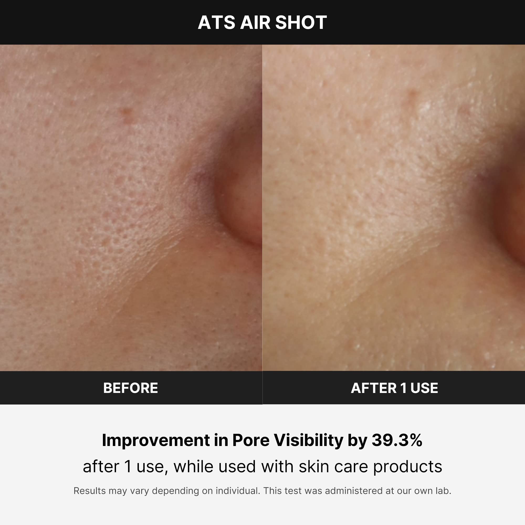 Foto 4 pulgar | Dispositivo  Medicube Age-r Ats Air Shot - Venta Internacional